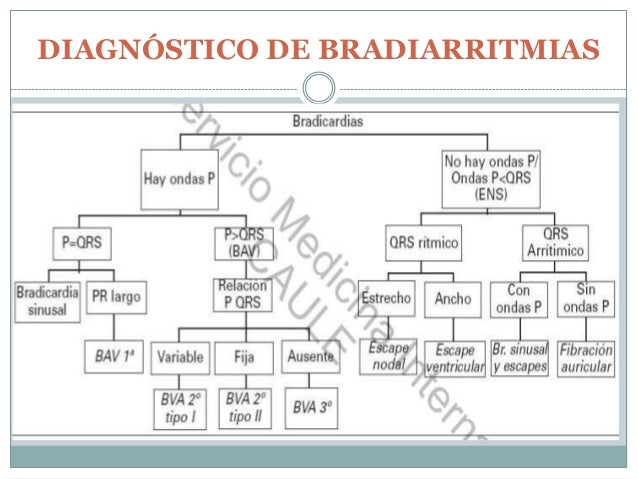 bradiarritmias